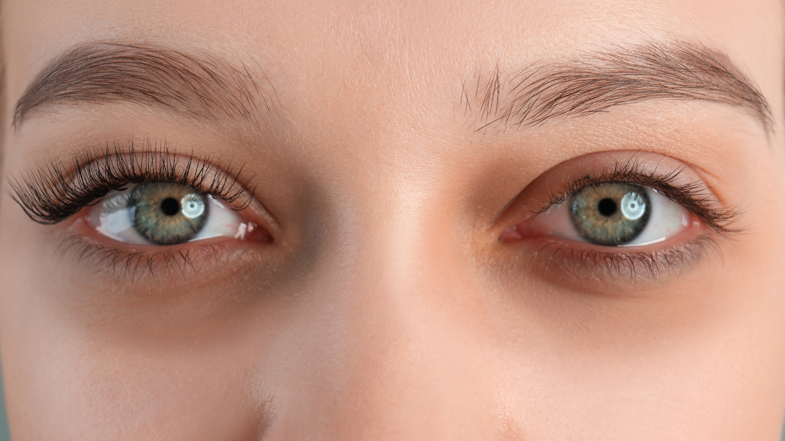 לחתנים ולכלות – מה עושים עם כהויות מתחת לעיניים?